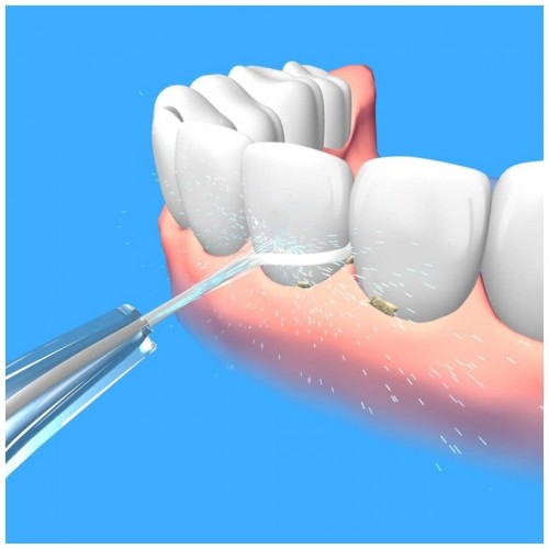 Ирригатор Jetpik JP50 Star (белый) 3